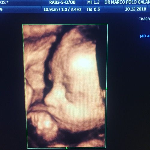 Dr. Marco Polo Galán Yáñez