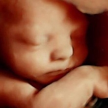 Dr. Jorge Irvin Aguirre Castro