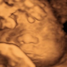 Lely Carrera Gutierrez