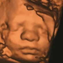 Dr. Oscar Aguirre Barrera