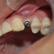 Dr. Avila Leonel Ponce